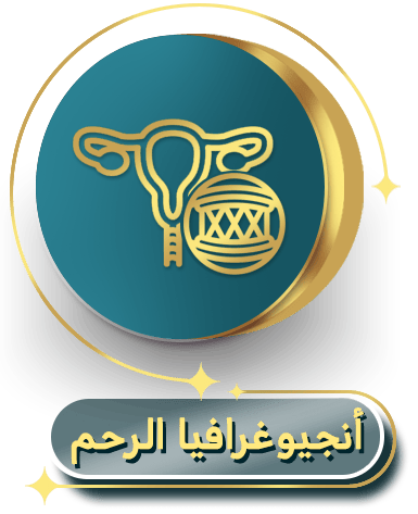 أنجيوغرافيا الرحم