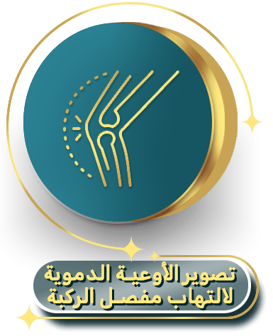 تصوير الأوعية الدموية لالتهاب مفصل الركبة