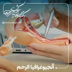 أنجيوغرافيا الرحم