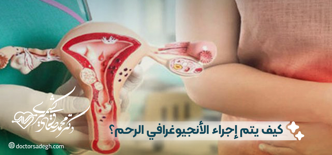 كيف يتم إجراء الأنجيوغرافي الرحم؟