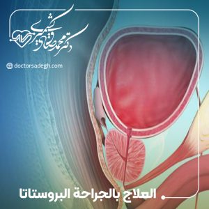 العلاج بالجراحة لتضخم البروستاتا