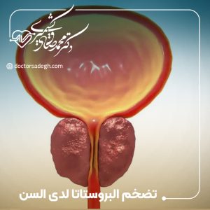 تضخم البروستاتا لدى كبار السن
