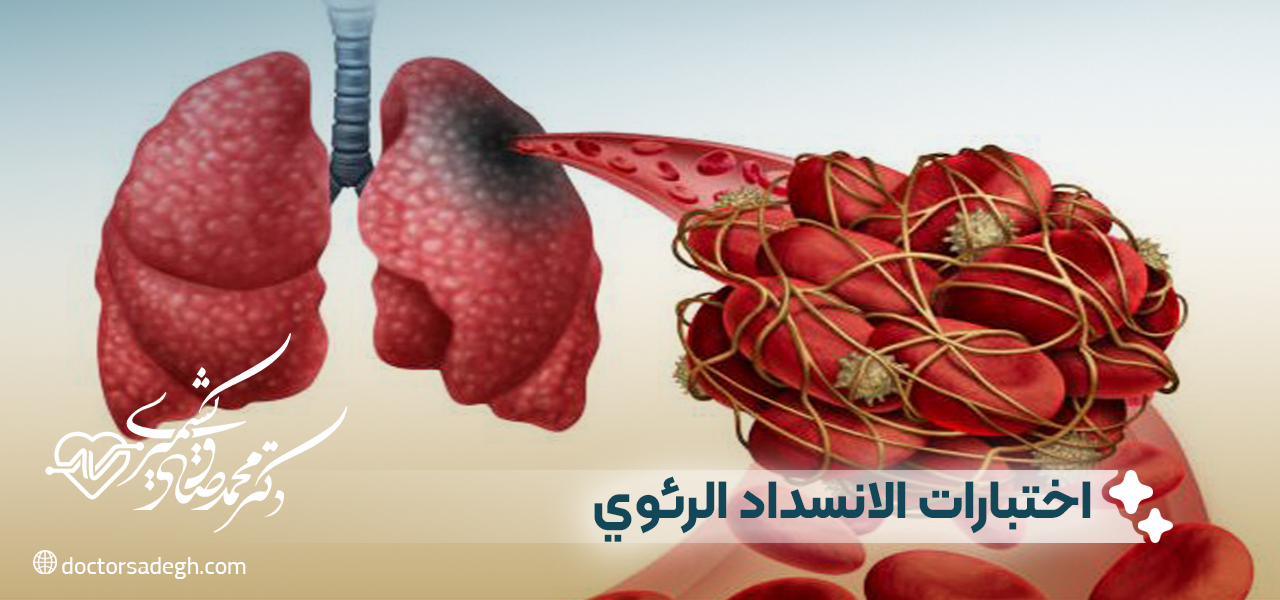 الفحوصات المخبرية الأخرى لانصمام الرئوي