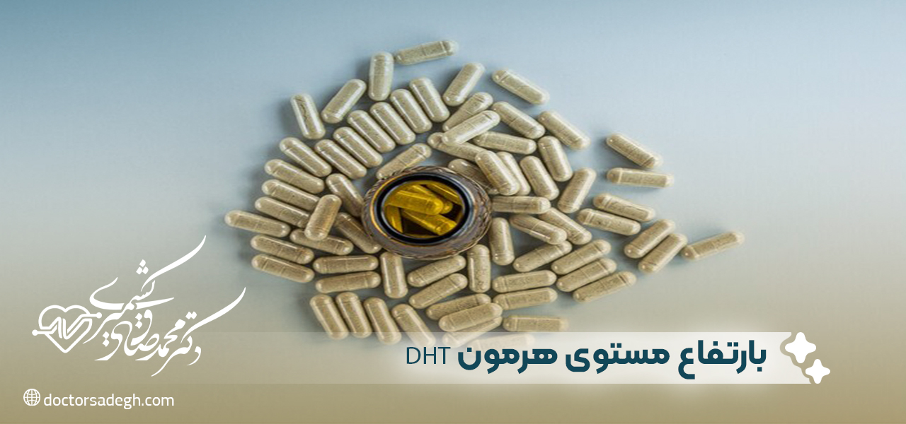 مشاكل مرتبطة بارتفاع مستوى هرمون DHT