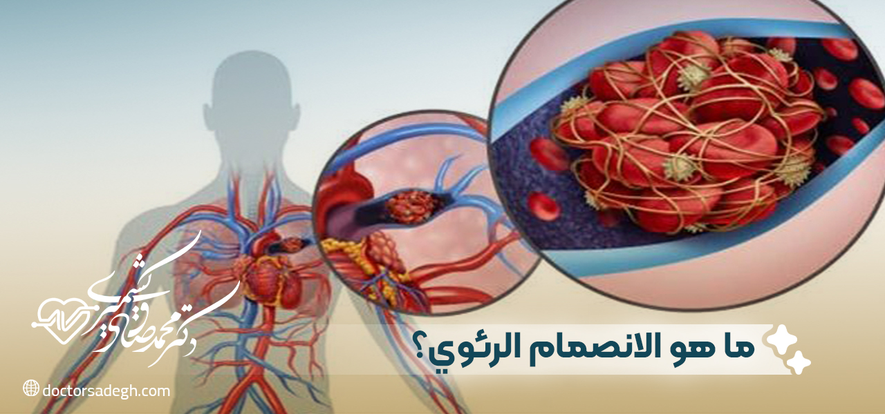 ما هو الانصمام الرئوي؟