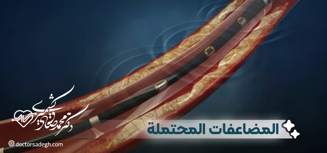 المضاعفات المحتملة