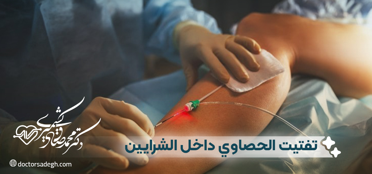 مفهوم تفتيت الحصاوي داخل الشرايين