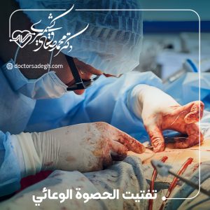 تفتيت الحصوة الوعائي