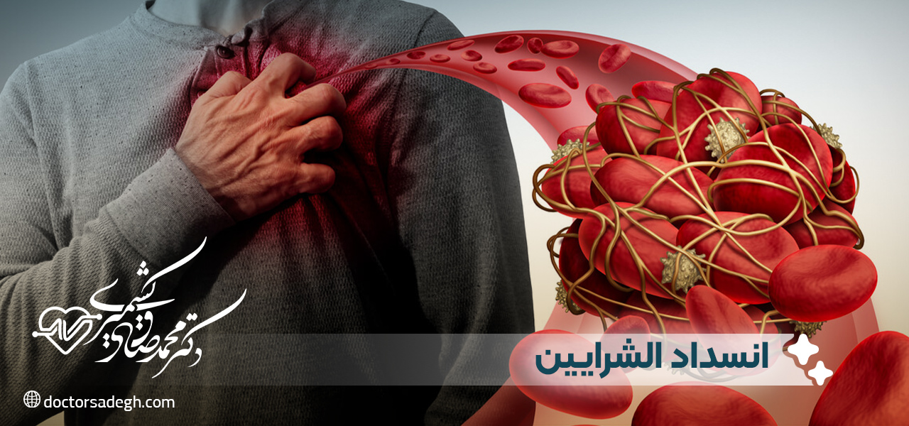 ما هو انسداد الشرايين وكيف يحدث؟