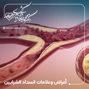 أعراض وعلامات انسداد الشرايين